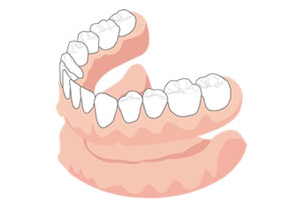 総入れ歯の場合